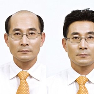 ��ʿͷ������Ƭ��Σ�� ͷ���淢�ٷ�Ƭ