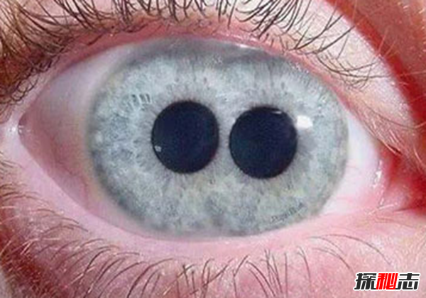 ˫ͫ׵Ĵ ˫ͫ׵˽