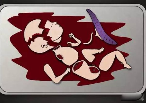 ̥ȫķ 4׶̥ൽж