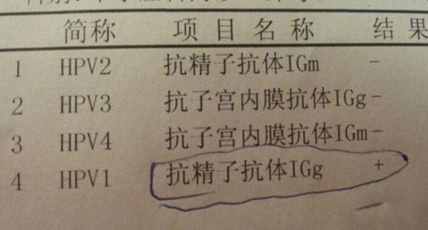 gpalԪ gpal鵥Ǽʲô