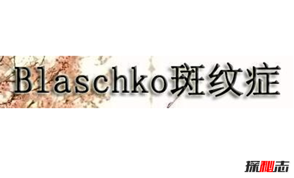 Blaschko֢ʲô Ĺֲ֢