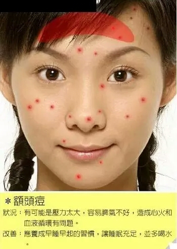 λͼ Ϊʲôԭ