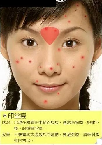 λͼ Ϊʲôԭ