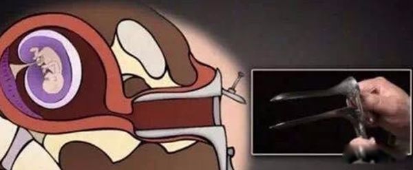 ̥Ĺ뻯ⷽ ̥ĺȥ