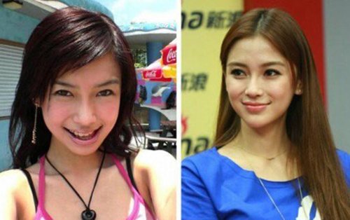 ��ӱ���������Ǽ� ����ǰ�����֢