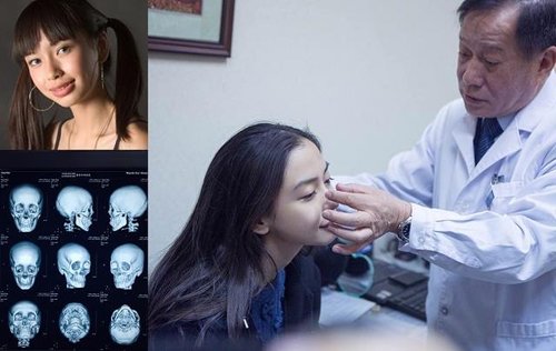 ��ӱ���������Ǽ� ����ǰ�����֢