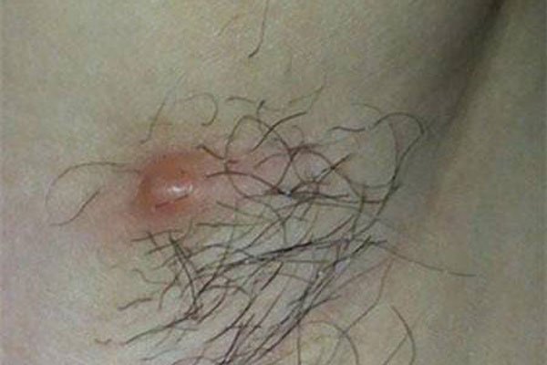 Ҹ�³�С�⾾��ͼƬ ���β����Ƿ�ᴫȾ��������