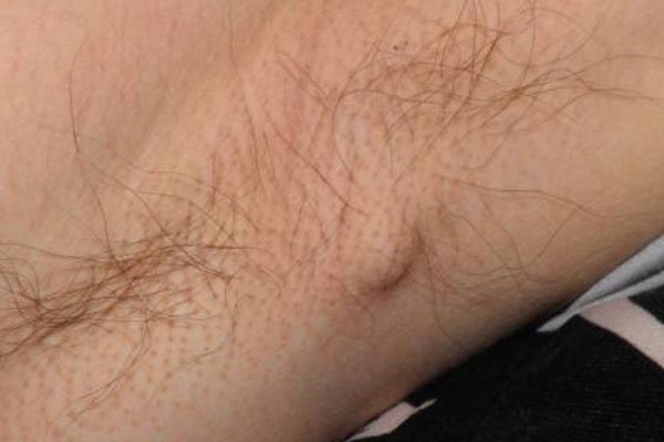 Ҹ�³�С�⾾��ͼƬ ���β����Ƿ�ᴫȾ��������