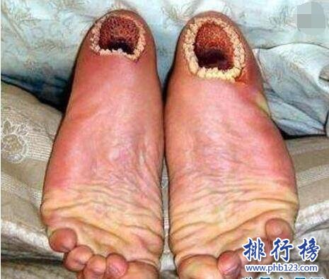 տָͼƬ ּѵĶͼƬҪע