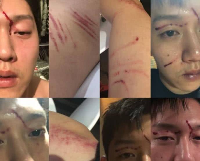 �ߺ����������ϼ��ͼƬ ǰ���ѱ��ߺ����ұ������жദ�˿�