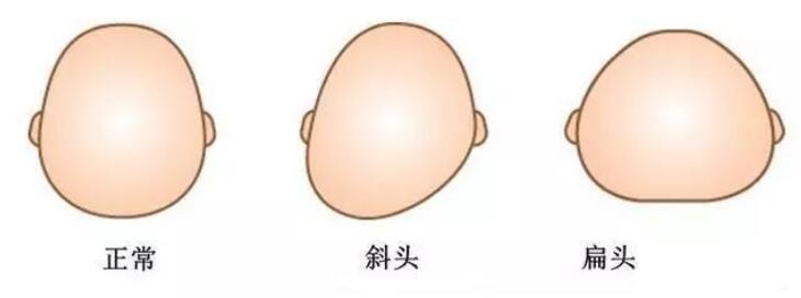 ͷ˲泤úó ӱͷ˯