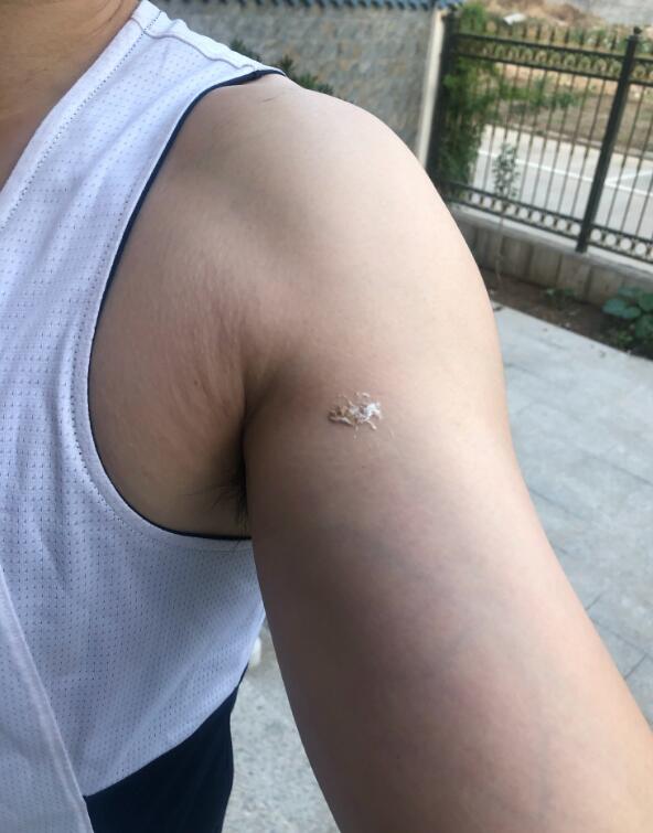 ʺϰʾʲô ҪߺˣʺͷϵԤ
