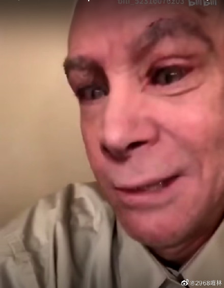 ��������Ĵ����� �������᣺�������������˲�����۶�ͼ