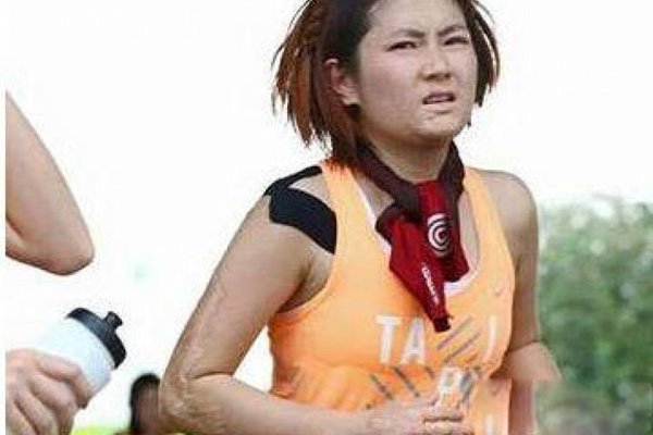 selina为什么无性婚姻 烧伤程度:selina前夫张承中分手原因