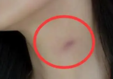 �ֲ�ݮ�ļ��ɺ���ȷ��ʽ ��Ů��������ݮ��ȷ����