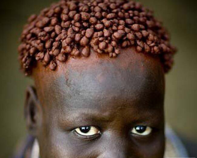 非洲割礼割的是哪里 恪守贞操:为什么非洲女孩要割礼