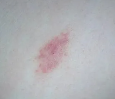 ��ݮӡ��ô�������� �ƿغ����ȣ�����ݮӡ�ļ��ɺ���ȷ��ʽ