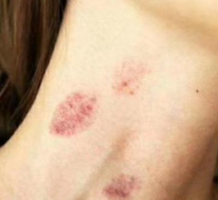 ��ݮӡ��ô�������� ���Ǻţ�����ݮ�Ĳ��輼�ɺ�λ��