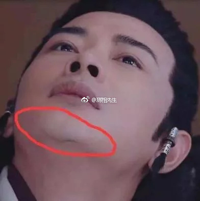 下巴疤痕面相图解 两种情况:下巴有疤痕影响运势吗