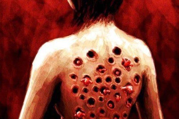 �����к�Ϊʲô�������к� �ܼ��־�֢��Ϊʲô�����к����г���