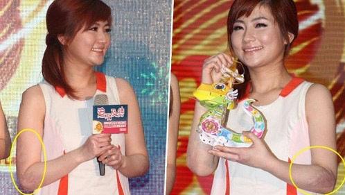 selina�����¼�ǰ��Ա� �ֲ��̺ۣ��ų��к�selinaΪʲô��������