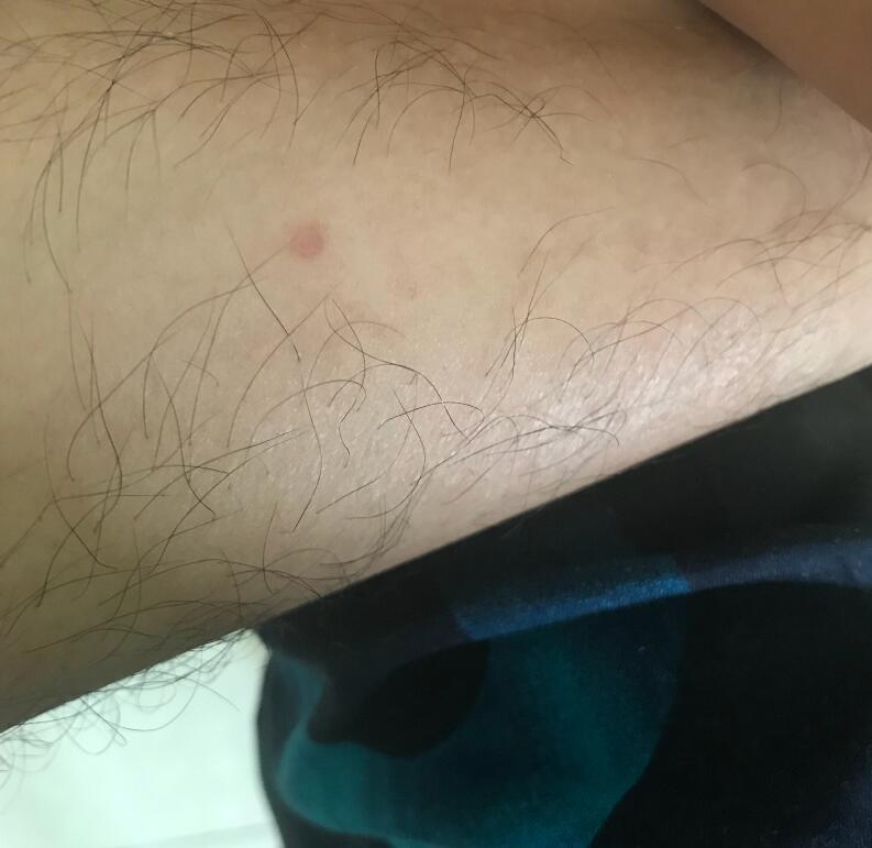 �Ŵ��ع�ɰ��ʲô��˼ Բ������ʧ���ع�ɰ��λ��ͼƬ