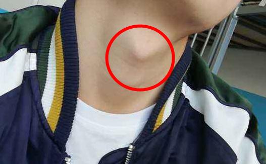 Ӧ ӲֲݮΣ